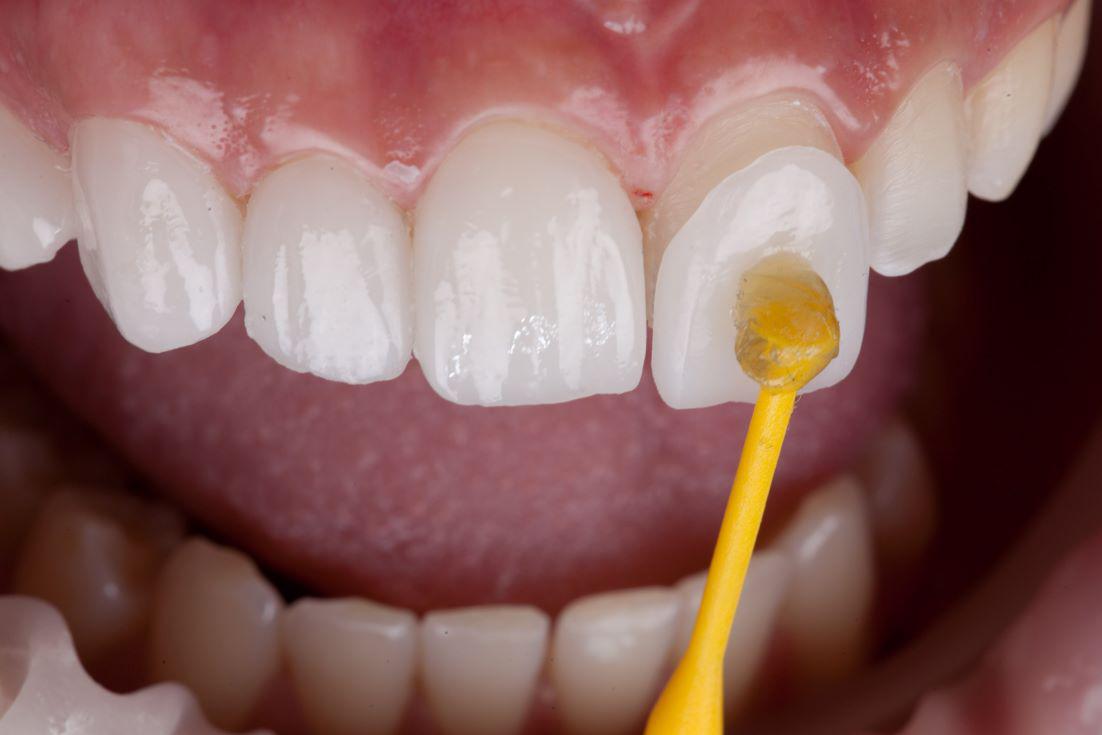 Carlston Dental Group Carlston Dental Group