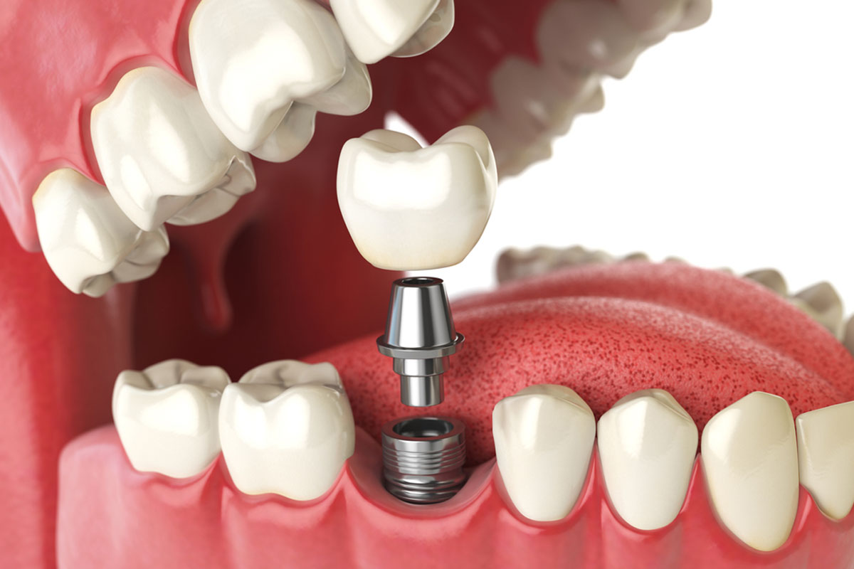 Carlston Dental Group Carlston Dental Group