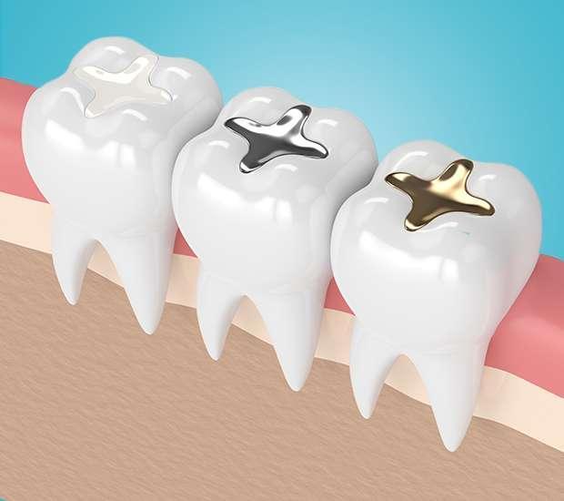 Carlston Dental Group Carlston Dental Group