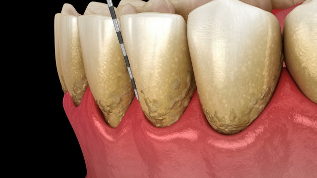 Carlston Dental Group Carlston Dental Group