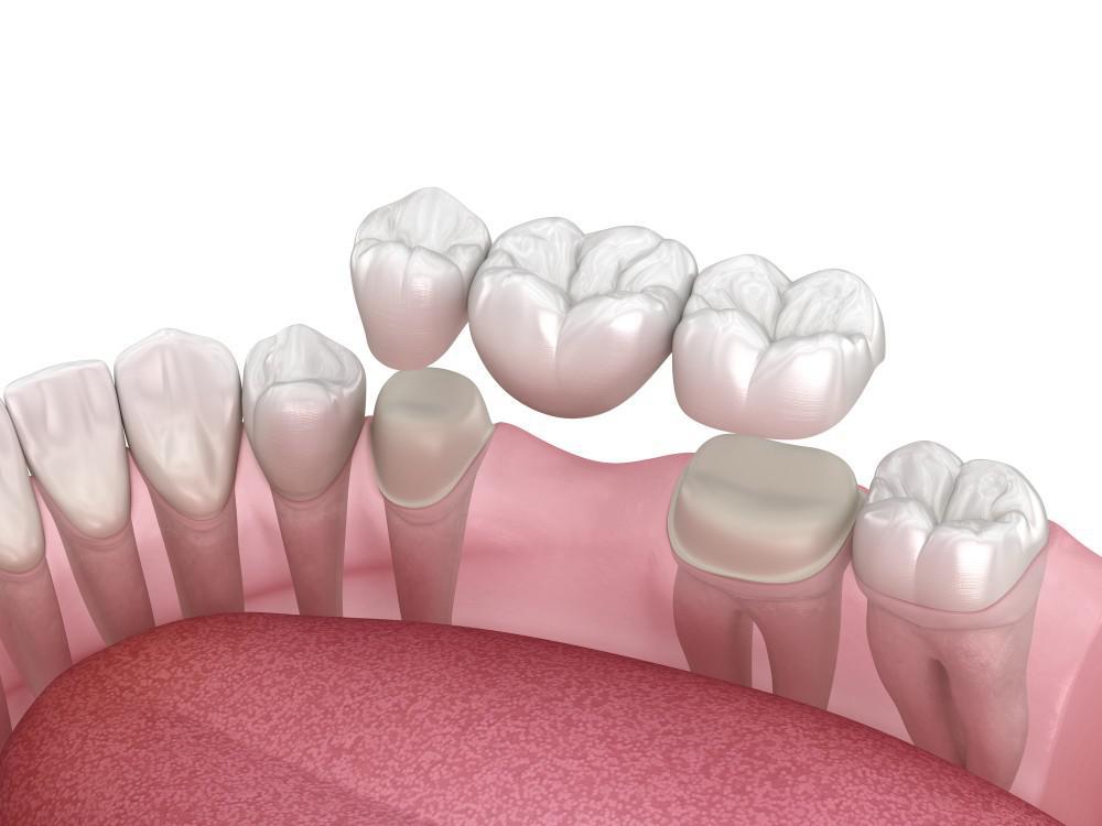 Carlston Dental Group Carlston Dental Group