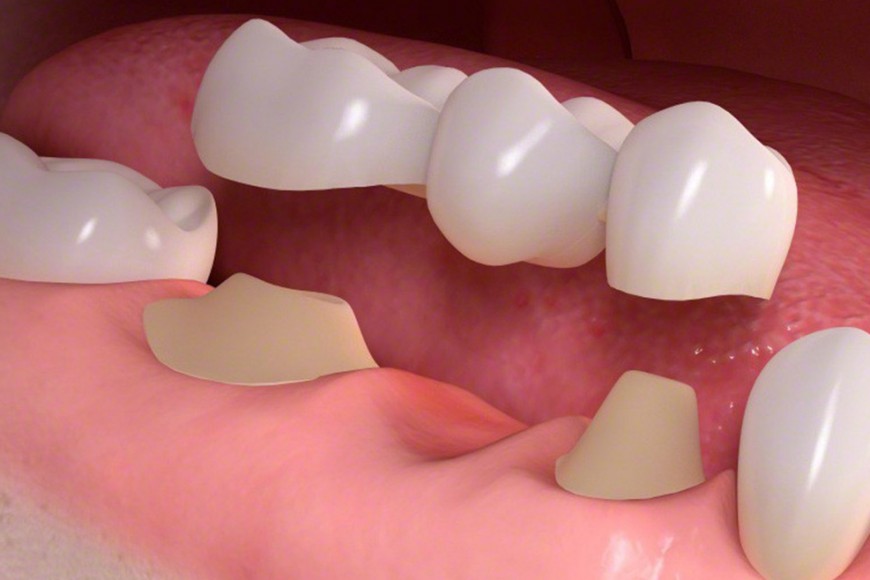 Carlston Dental Group Carlston Dental Group