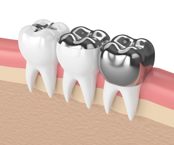 Carlston Dental Group Carlston Dental Group