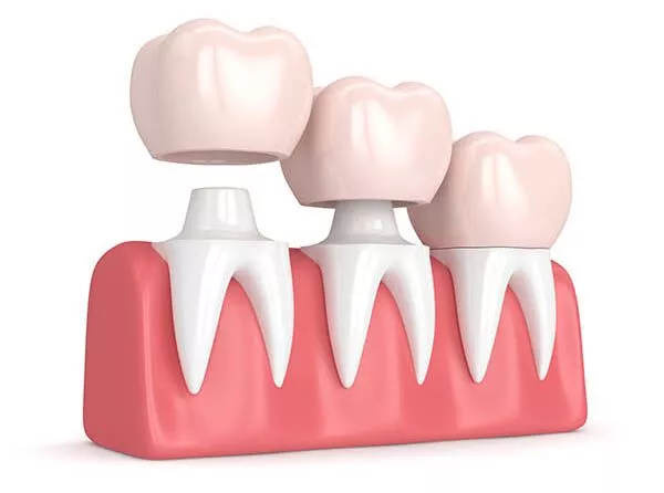 Carlston Dental Group Carlston Dental Group