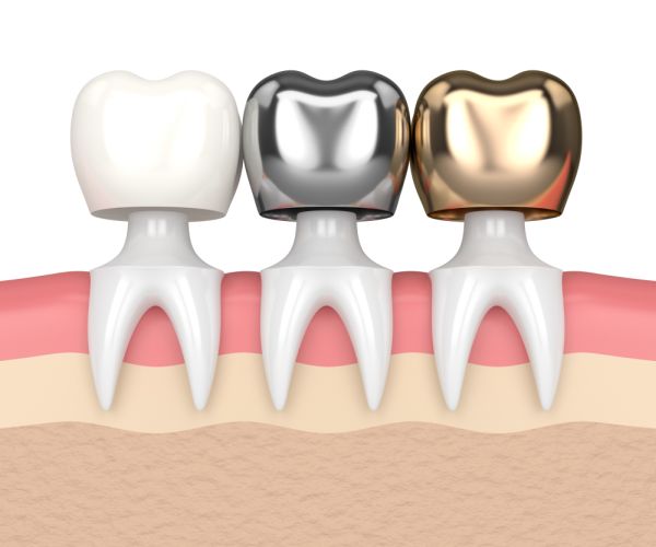 Carlston Dental Group Carlston Dental Group