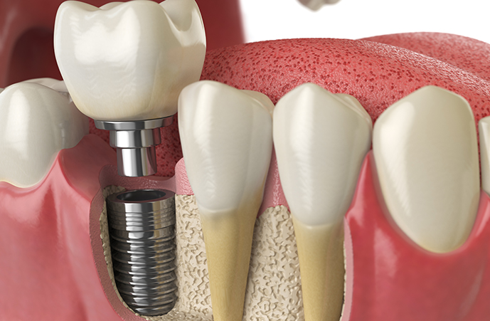 Carlston Dental Group Carlston Dental Group