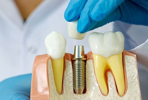 Carlston Dental Group Carlston Dental Group