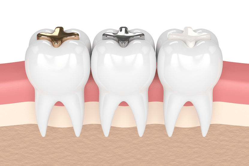 Carlston Dental Group Carlston Dental Group