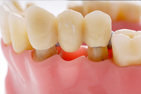 Carlston Dental Group Carlston Dental Group