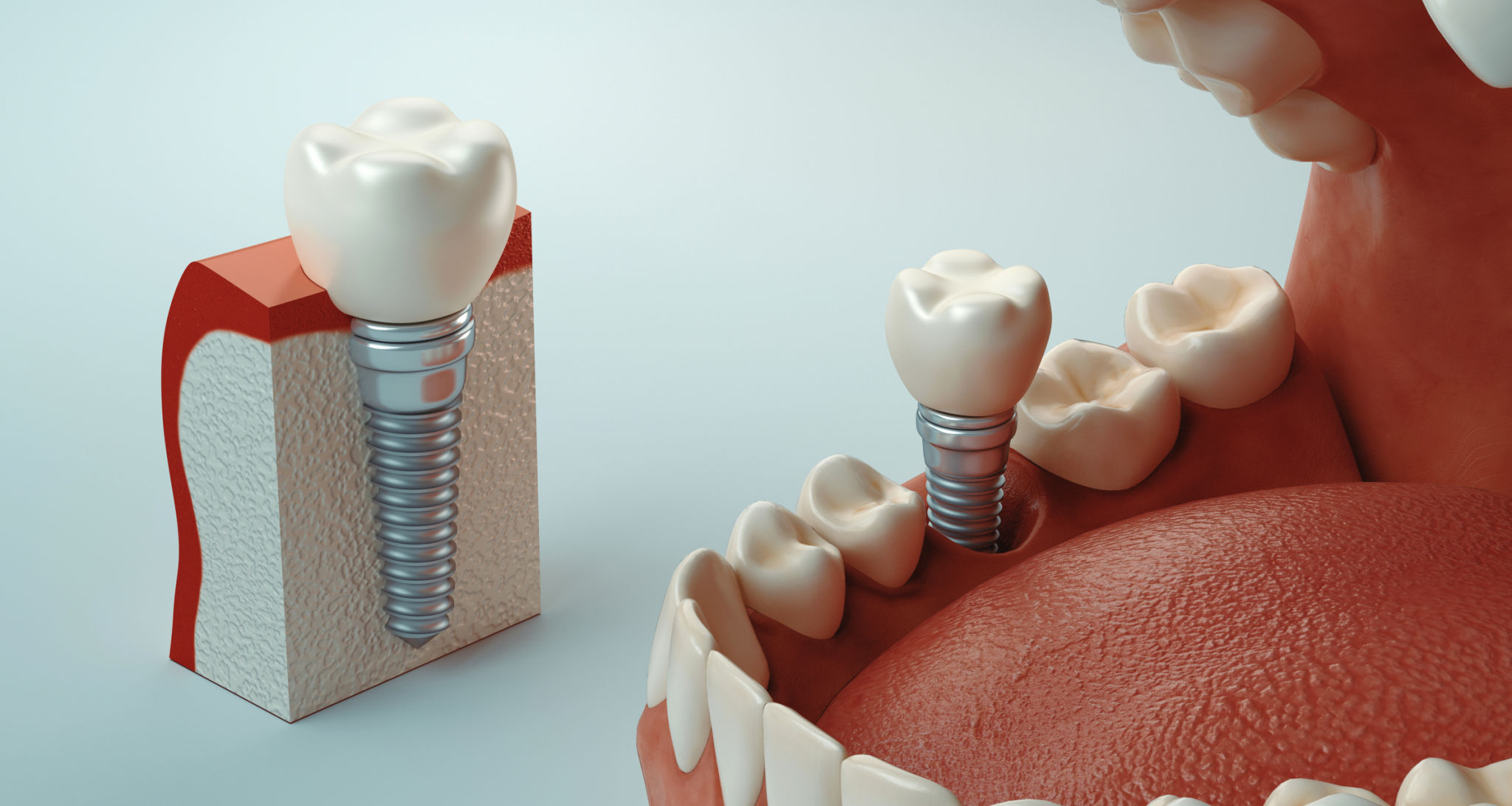 Carlston Dental Group Carlston Dental Group