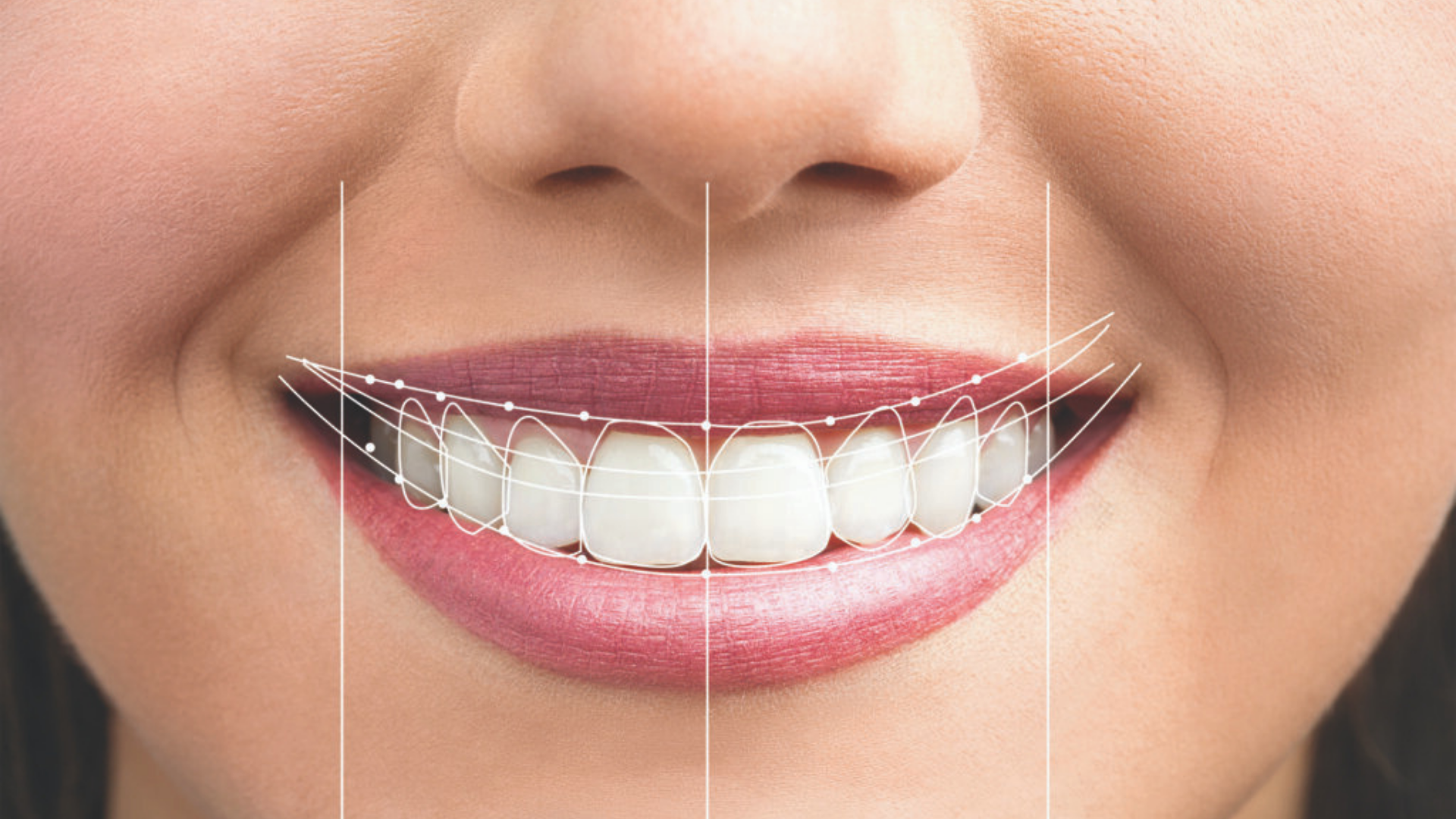 Benefits of Digital Smile Design Benefits of Digital Smile Design
