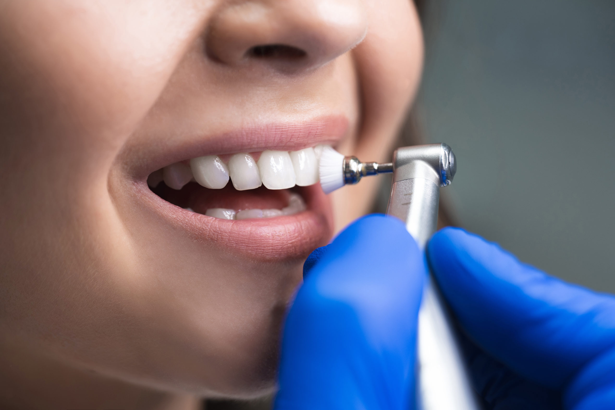Teeth Cleaning Teeth Cleaning