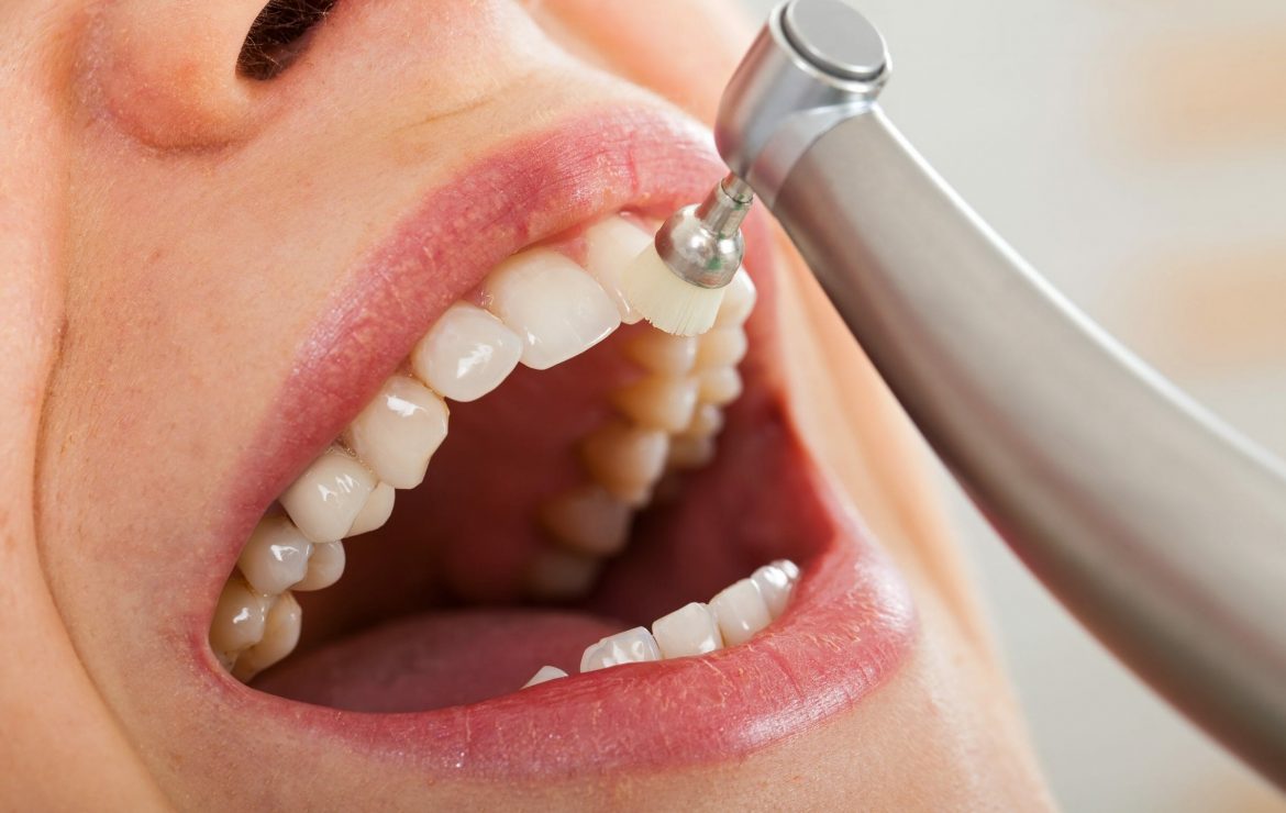 Preventative Dentistry Preventative Dentistry