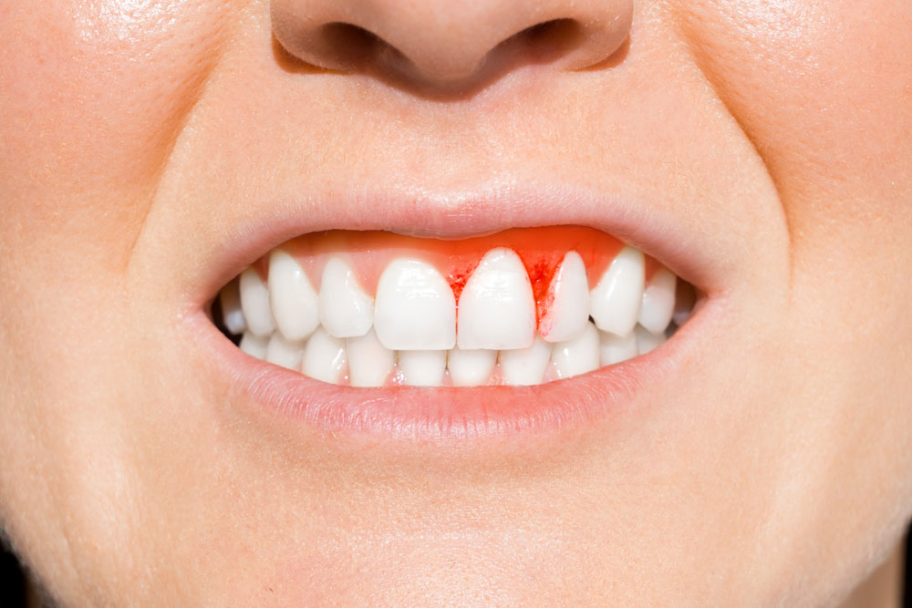 Carlston Dental Group Carlston Dental Group