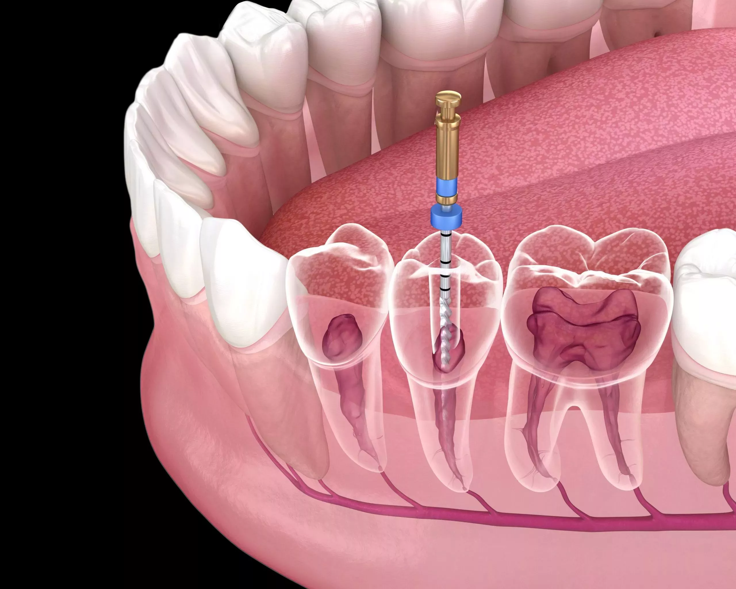Carlston Dental Group Carlston Dental Group