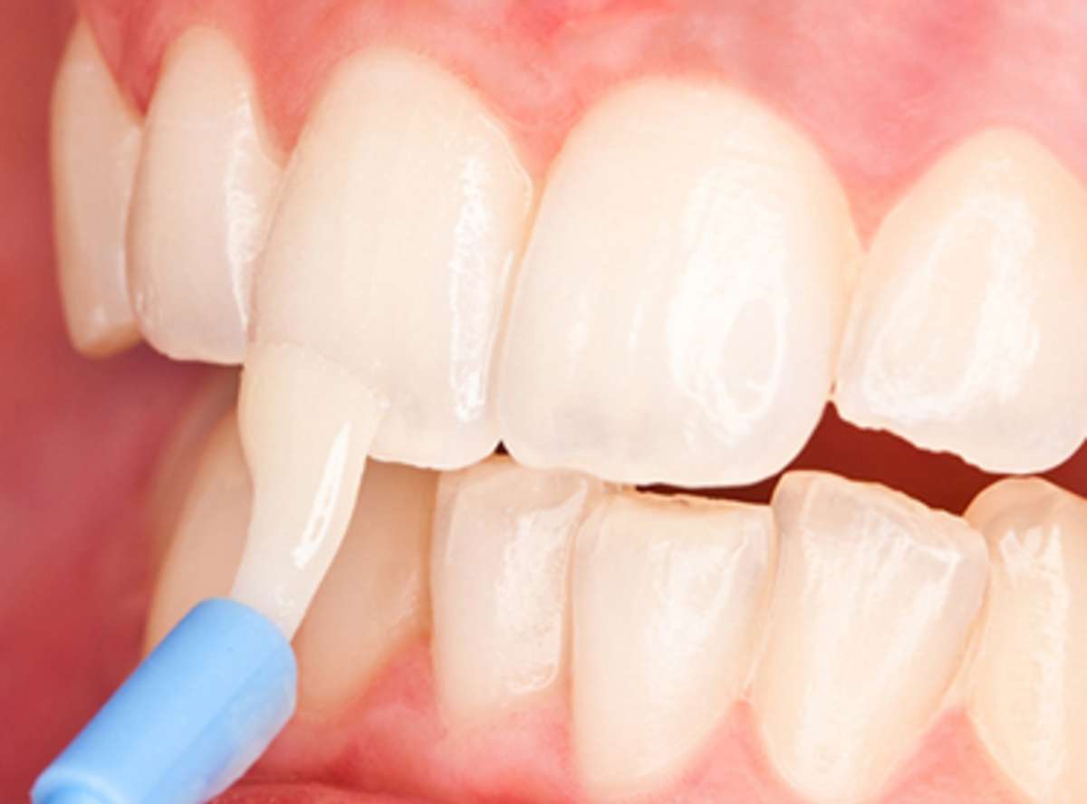 Carlston Dental Group Carlston Dental Group