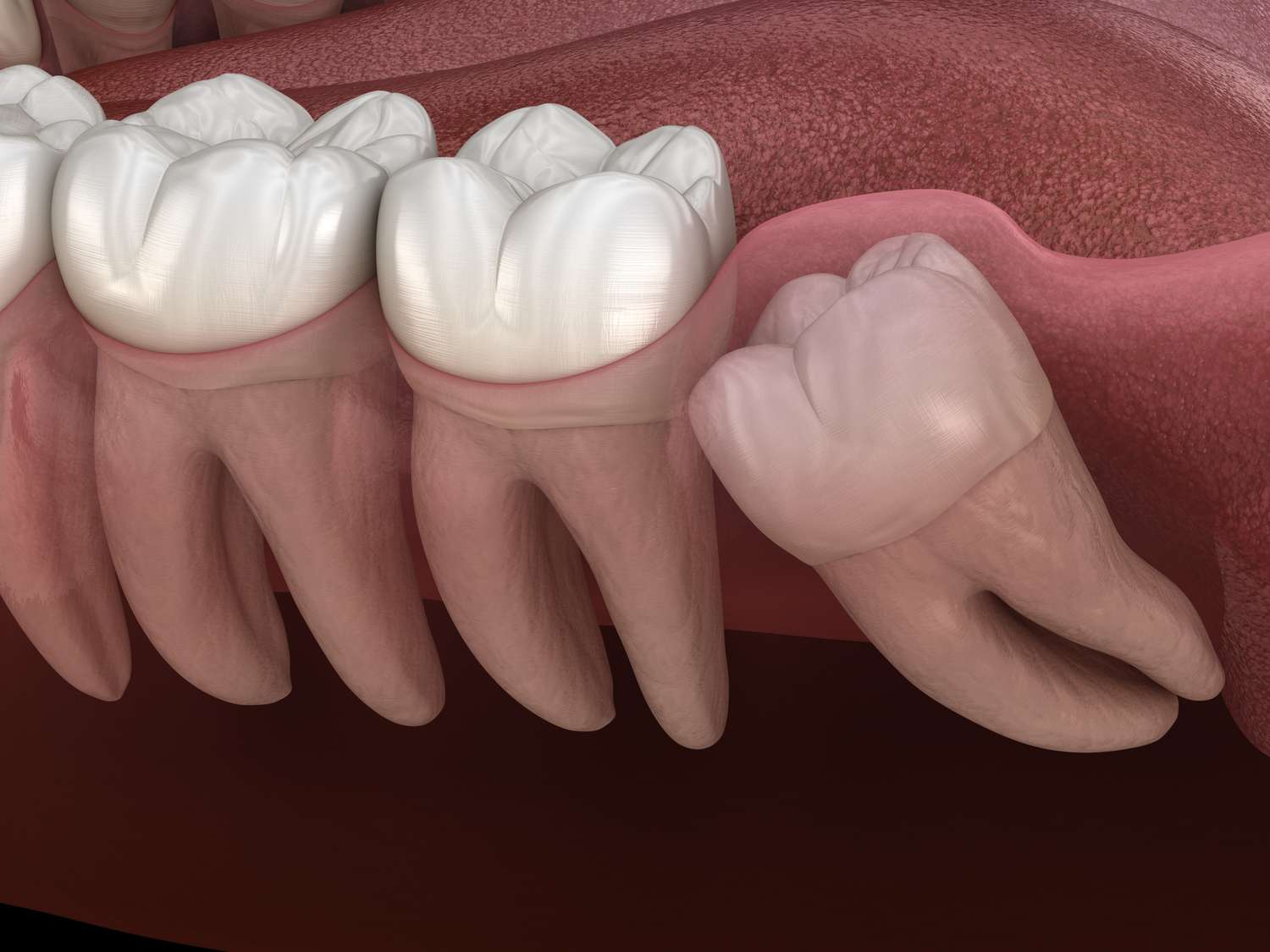 Carlston Dental Group Carlston Dental Group