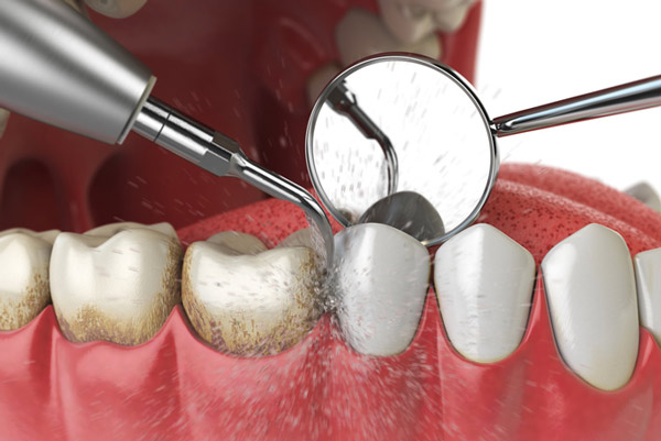 Carlston Dental Group Carlston Dental Group