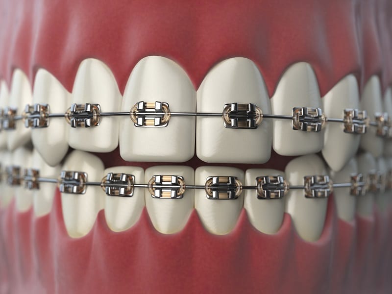 Carlston Dental Group Carlston Dental Group