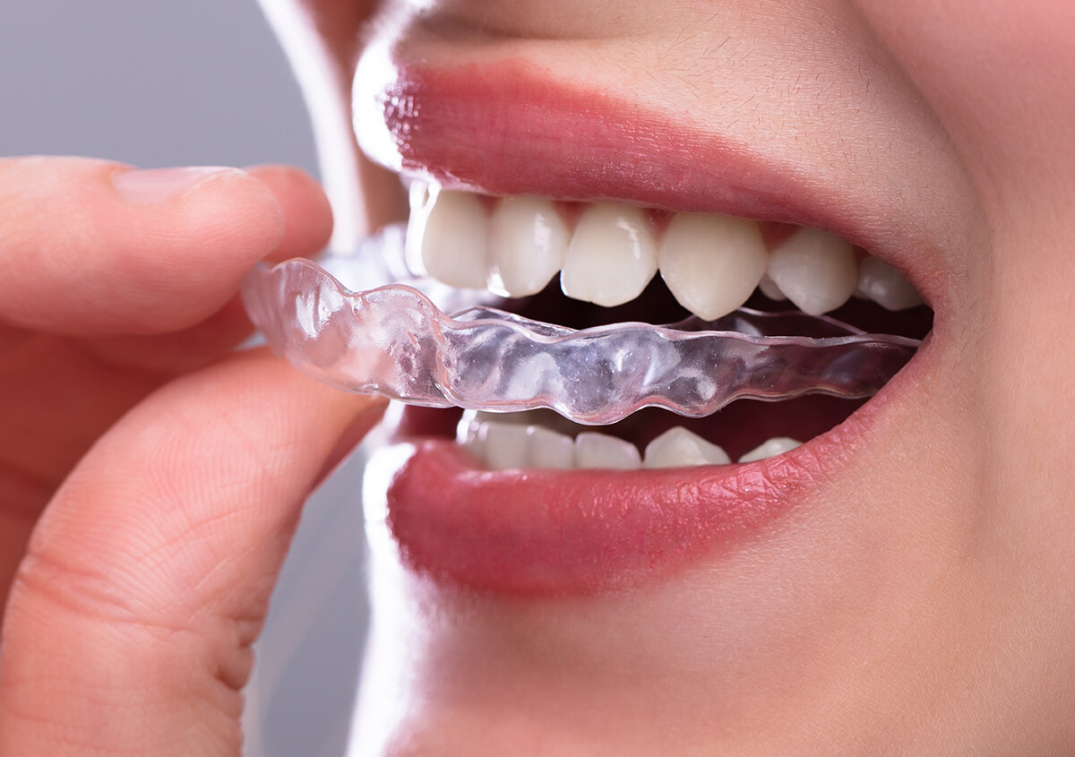 Carlston Dental Group Carlston Dental Group