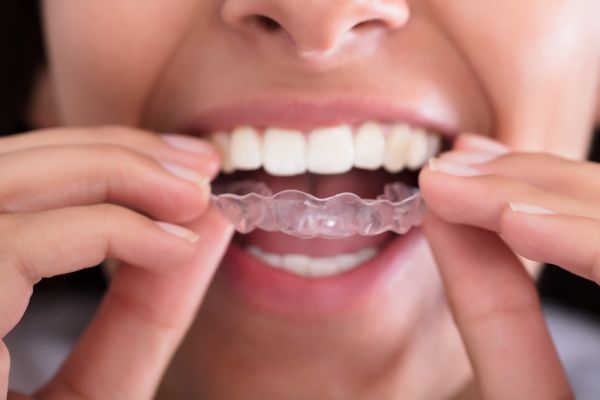 Carlston Dental Group Carlston Dental Group