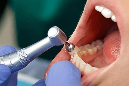 Carlston Dental Group Carlston Dental Group