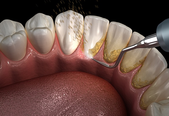 Carlston Dental Group Carlston Dental Group