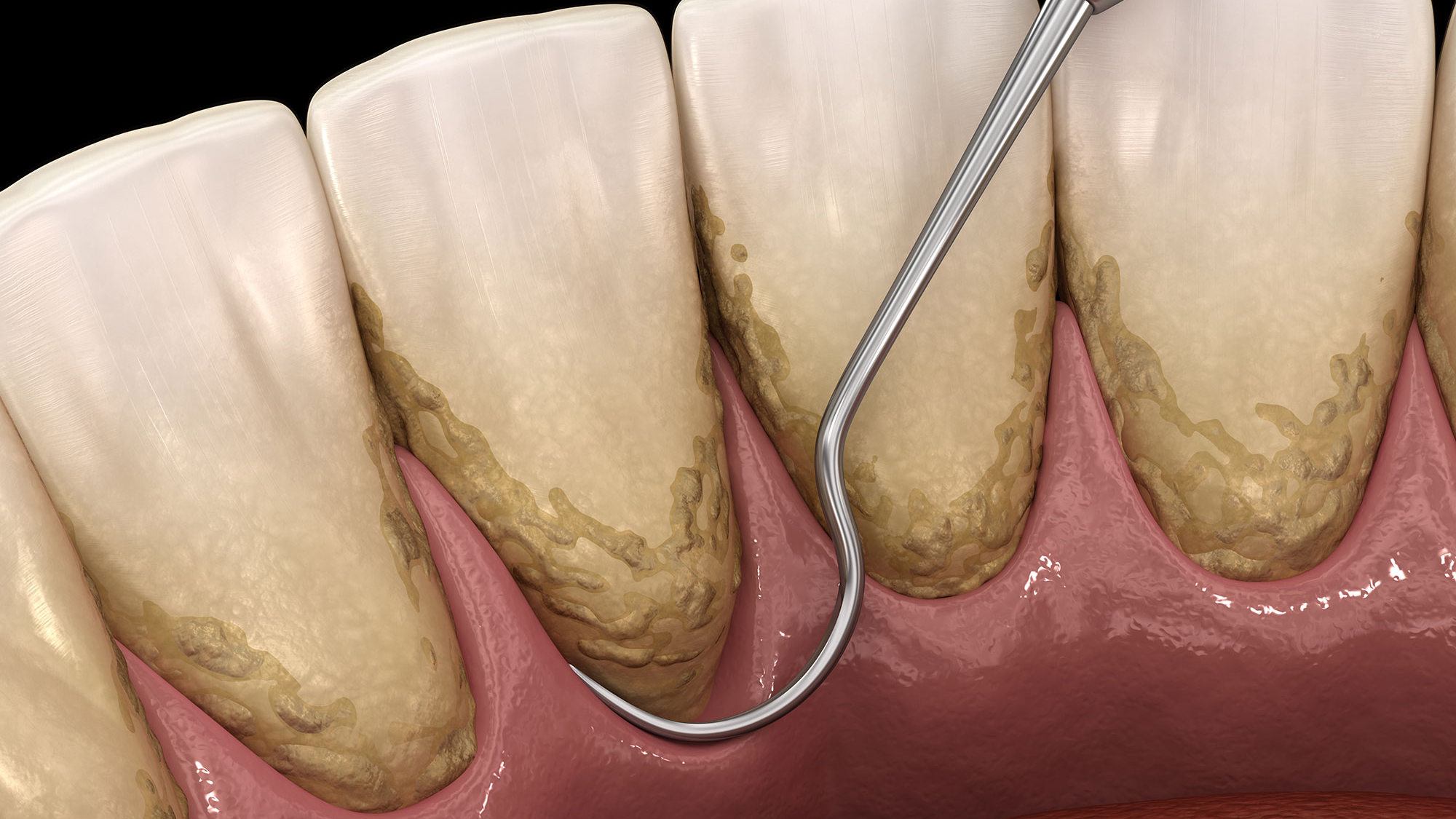 Carlston Dental Group Carlston Dental Group