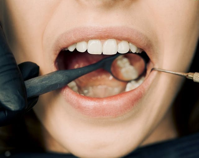 This is a thumbnail image of blog 5. Tongue Talk: What That White Coating Really Means (and What to Do About It) This is a thumbnail image of blog 5. Tongue Talk: What That White Coating Really Means (and What to Do About It)