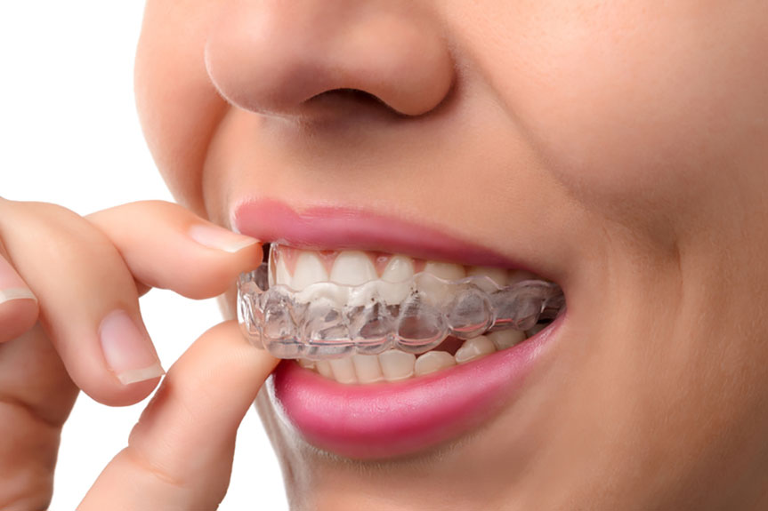 Carlston Dental Group Carlston Dental Group