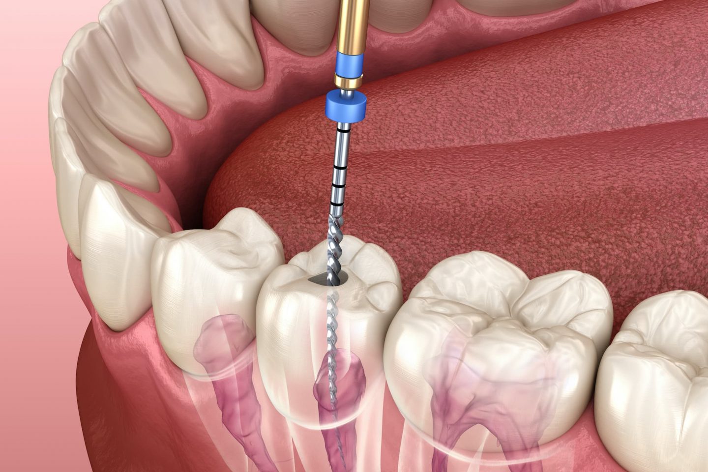 Carlston Dental Group Carlston Dental Group