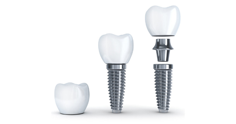 Carlston Dental Group Carlston Dental Group