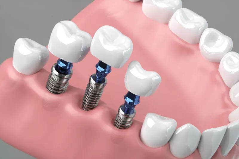 Carlston Dental Group Carlston Dental Group