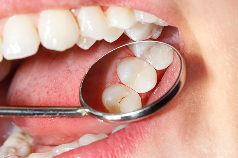 Carlston Dental Group Carlston Dental Group