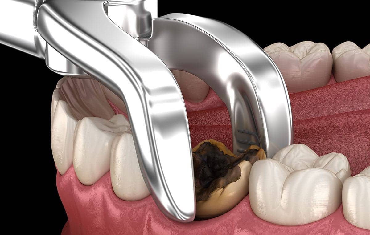 Carlston Dental Group Carlston Dental Group