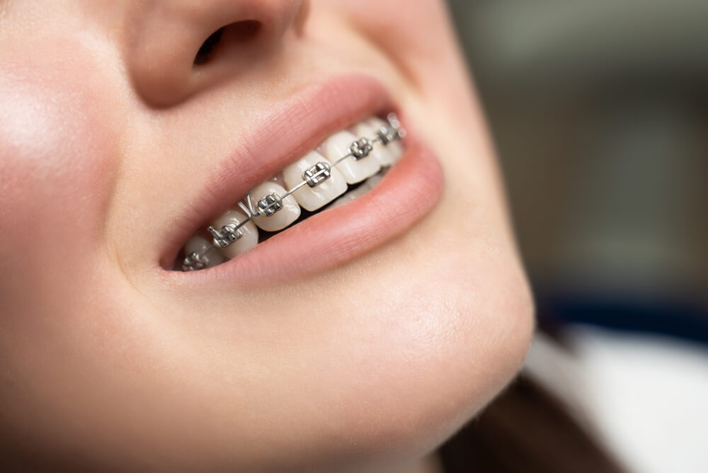 Carlston Dental Group Carlston Dental Group