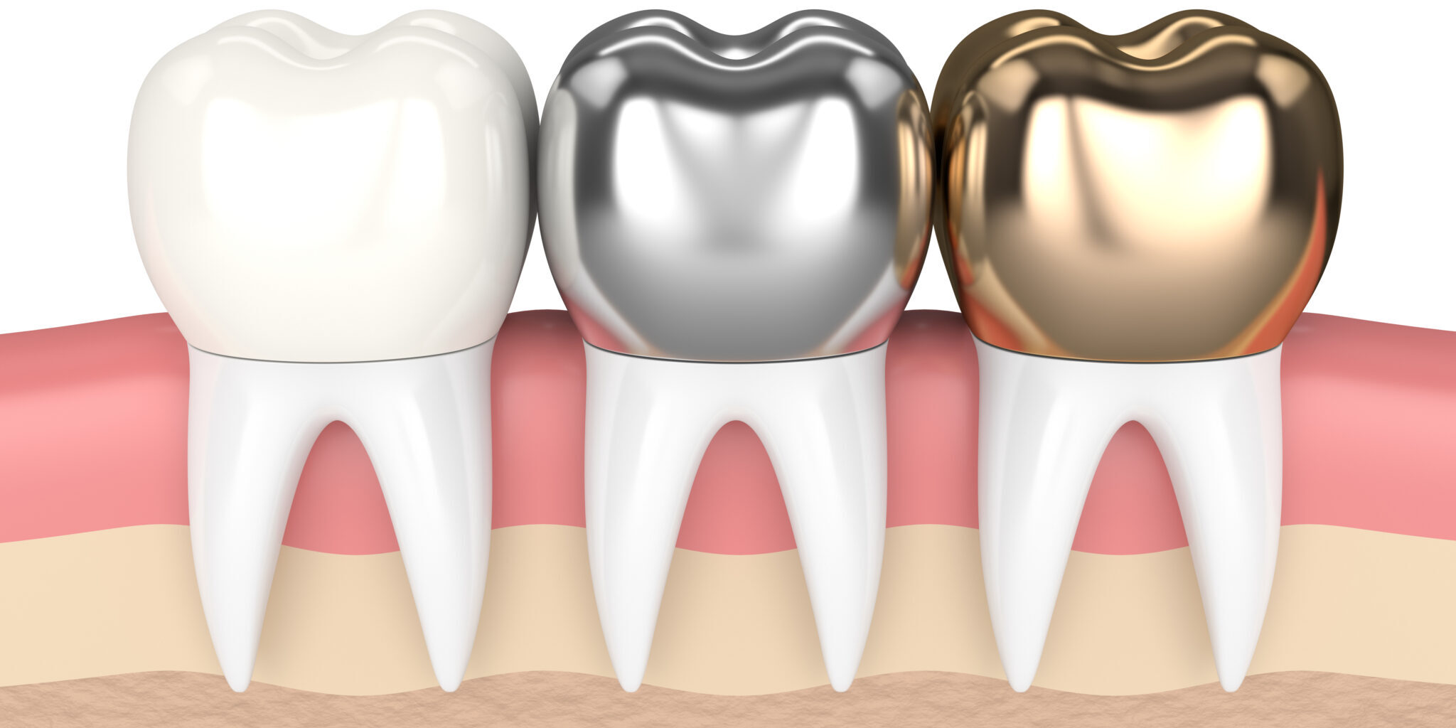 Carlston Dental Group Carlston Dental Group
