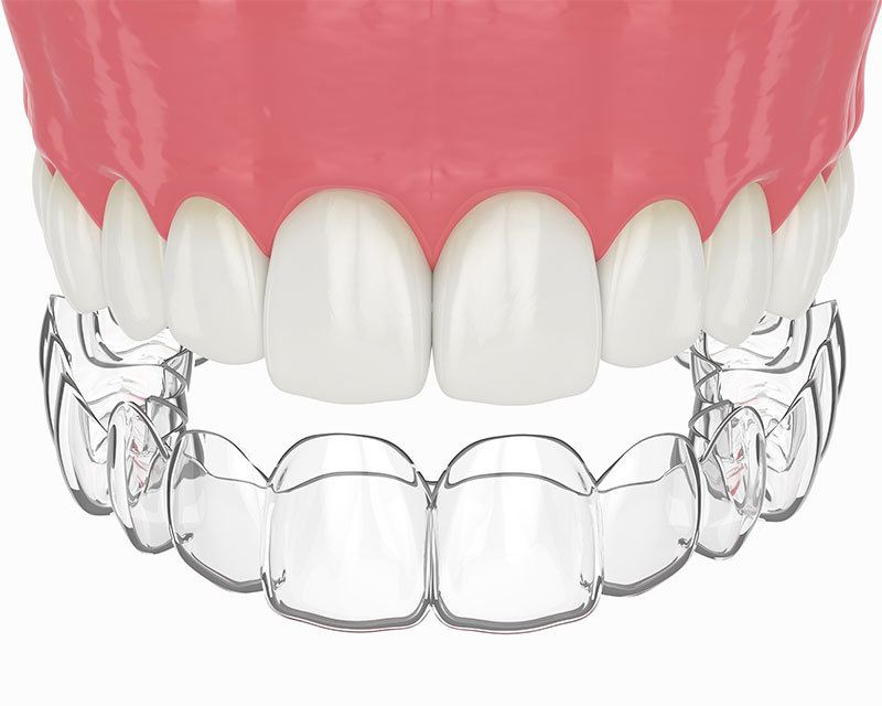 Carlston Dental Group Carlston Dental Group