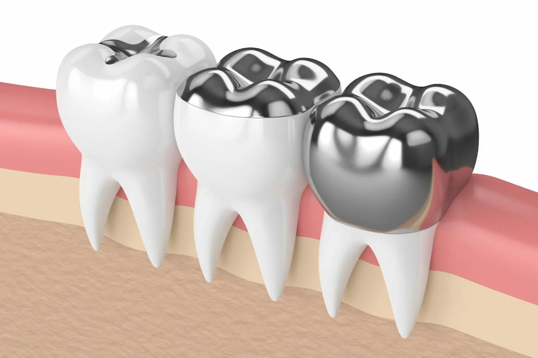 Carlston Dental Group Carlston Dental Group